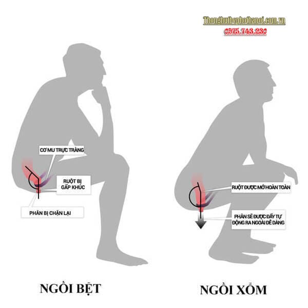 Vì sao tư thế ngồi bồn cầu đúng cách lại quan trọng?
